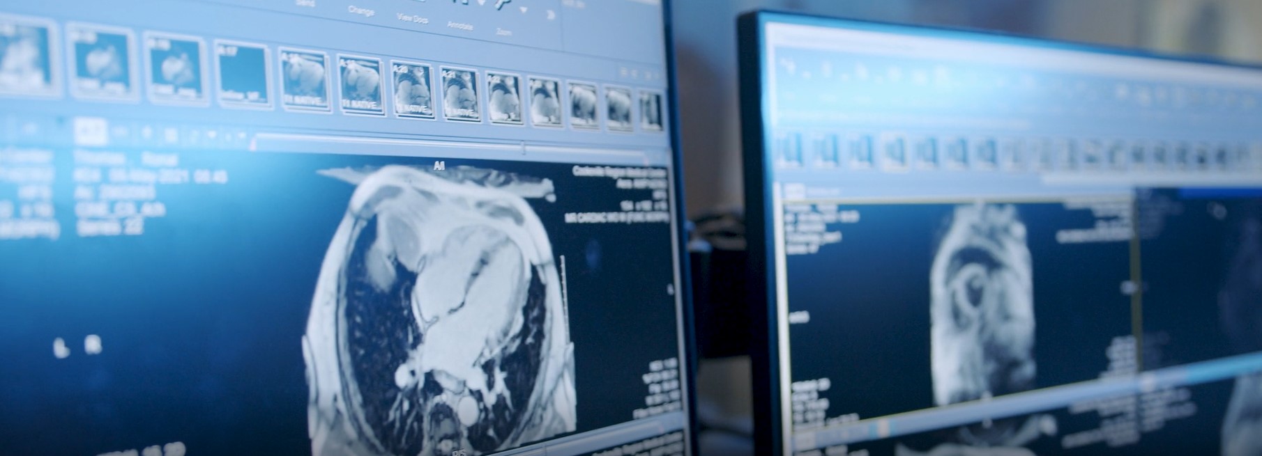 monitor showing cardiac images